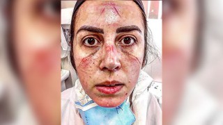 VİRÜSLE MÜCADELENİN SON FOTOĞRAFI