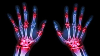 DİKKAT! KALICI SAKATLIK VE KISITLILIĞA NEDEN OLABİLİR